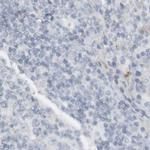 RTN3 Antibody in Immunohistochemistry (IHC)