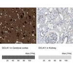 DCLK1 Antibody