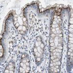 B4GALNT2 Antibody in Immunohistochemistry (Paraffin) (IHC (P))