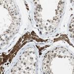 NEK4 Antibody in Immunohistochemistry (IHC)