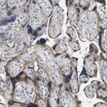 LPHN3 Antibody in Immunohistochemistry (Paraffin) (IHC (P))