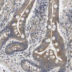 LPHN3 Antibody in Immunohistochemistry (Paraffin) (IHC (P))