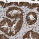 LPHN3 Antibody in Immunohistochemistry (Paraffin) (IHC (P))