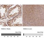 NSD2 Antibody in Immunohistochemistry (IHC)