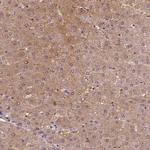 NSD2 Antibody in Immunohistochemistry (IHC)