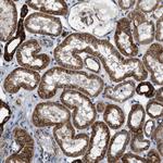 PCLO Antibody in Immunohistochemistry (Paraffin) (IHC (P))