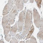 PCLO Antibody in Immunohistochemistry (Paraffin) (IHC (P))