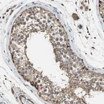 PCLO Antibody in Immunohistochemistry (Paraffin) (IHC (P))