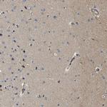 PCLO Antibody in Immunohistochemistry (IHC)