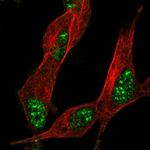 ZNF179 Antibody in Immunocytochemistry (ICC/IF)