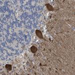 ZNF179 Antibody in Immunohistochemistry (Paraffin) (IHC (P))