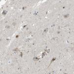 ZNF179 Antibody in Immunohistochemistry (Paraffin) (IHC (P))