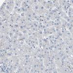 ZNF179 Antibody in Immunohistochemistry (Paraffin) (IHC (P))