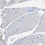 ZNF179 Antibody in Immunohistochemistry (Paraffin) (IHC (P))