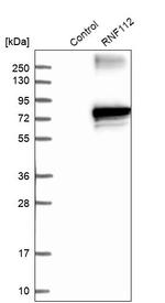 ZNF179 Antibody in Western Blot (WB)