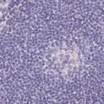 ASGR2 Antibody in Immunohistochemistry (Paraffin) (IHC (P))