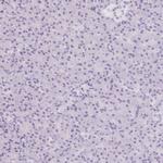 ASGR2 Antibody in Immunohistochemistry (Paraffin) (IHC (P))