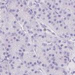 ASGR2 Antibody in Immunohistochemistry (Paraffin) (IHC (P))