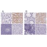 ASGR2 Antibody in Immunohistochemistry (IHC)