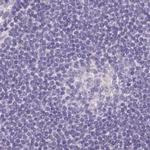 ASGR2 Antibody in Immunohistochemistry (IHC)