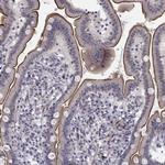 CHST8 Antibody in Immunohistochemistry (Paraffin) (IHC (P))