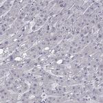 CHST8 Antibody in Immunohistochemistry (Paraffin) (IHC (P))