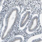 EVC Antibody in Immunohistochemistry (Paraffin) (IHC (P))