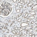 EVC Antibody in Immunohistochemistry (Paraffin) (IHC (P))