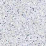 EVC Antibody in Immunohistochemistry (Paraffin) (IHC (P))