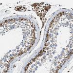 HSD17B12 Antibody in Immunohistochemistry (IHC)