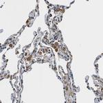 HSD17B12 Antibody in Immunohistochemistry (IHC)