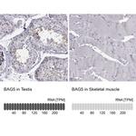 BAG5 Antibody in Immunohistochemistry (IHC)