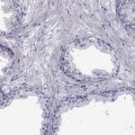 BAG5 Antibody in Immunohistochemistry (IHC)