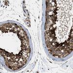 SRPK1 Antibody in Immunohistochemistry (IHC)