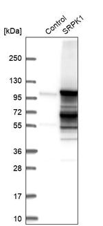 SRPK1 Antibody in Western Blot (WB)