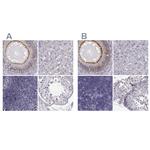 ZNF185 Antibody in Immunohistochemistry (IHC)