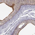 ZNF185 Antibody in Immunohistochemistry (IHC)