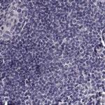 ZNF185 Antibody in Immunohistochemistry (IHC)