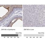 ZNF185 Antibody