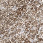 AGPAT6 Antibody in Immunohistochemistry (IHC)