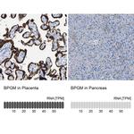 Bisphosphoglycerate mutase Antibody in Immunohistochemistry (IHC)