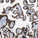 Bisphosphoglycerate mutase Antibody in Immunohistochemistry (IHC)