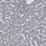 WNK2 Antibody in Immunohistochemistry (IHC)