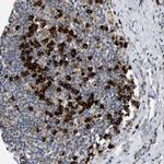 DERL1 Antibody in Immunohistochemistry (IHC)