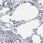 DERL1 Antibody in Immunohistochemistry (IHC)