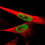 JMJD1B Antibody in Immunocytochemistry (ICC/IF)