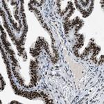 JMJD1B Antibody in Immunohistochemistry (Paraffin) (IHC (P))