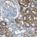 ASL Antibody in Immunohistochemistry (Paraffin) (IHC (P))