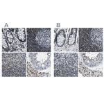 SP100 Antibody in Immunohistochemistry (IHC)