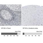 SP100 Antibody